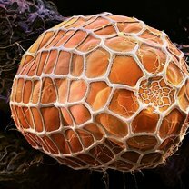 Фото приколы Яйца насекомых под микроскопом (10 фото)